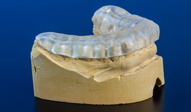 Model of row of teeth with clear nightguard covering them