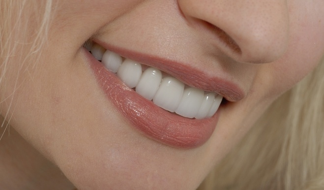 CLose up of blonde woman smiling with flawless teeth