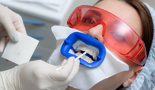 Patient receiving in-office teeth whitening