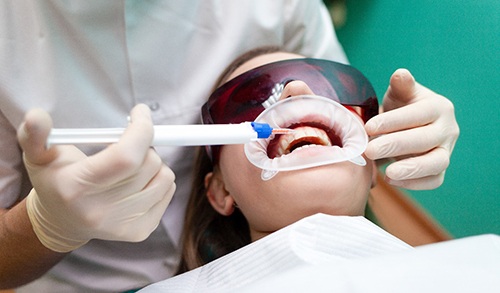 Woman receiving in-office whitening